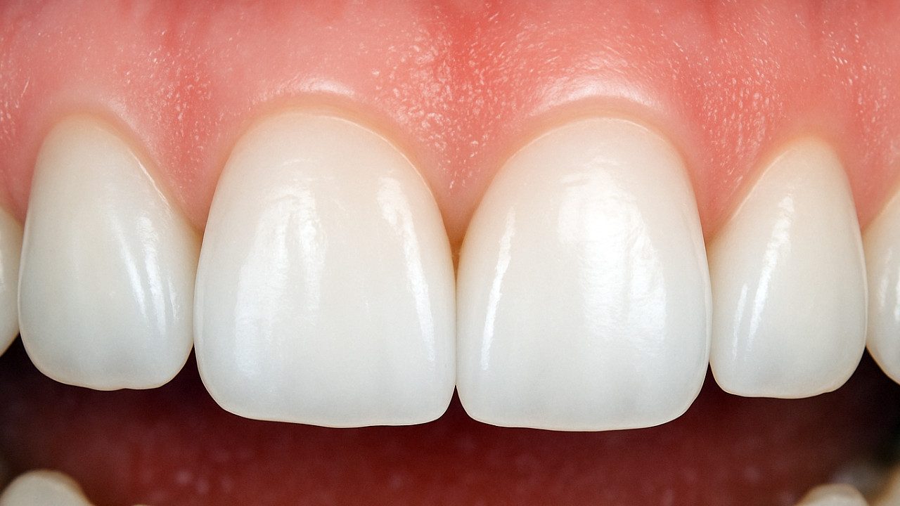 After-Dental-Crown-Treatment