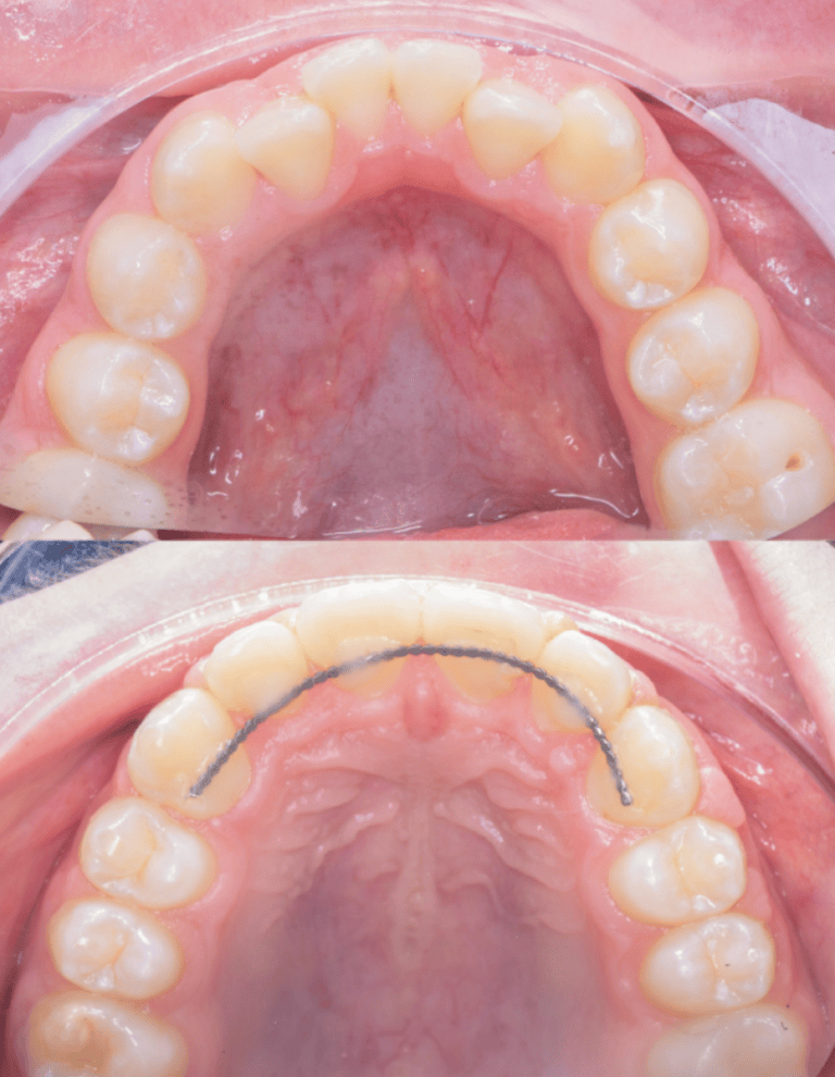 Daniel_Chia_Patient_Row_Before_and_After